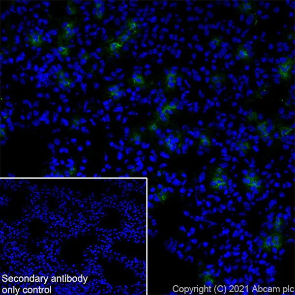 Immunohistochemistry (Frozen sections) - Anti-MMP9 antibody [RM1020] (AB283575)