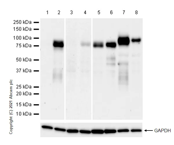 Western blot - Anti-MMP9 antibody [RM1020] (AB283575)