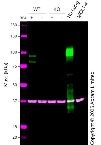 Western blot - Anti-MMP9 antibody [RM1020] (ab283575), expandable thumbnail