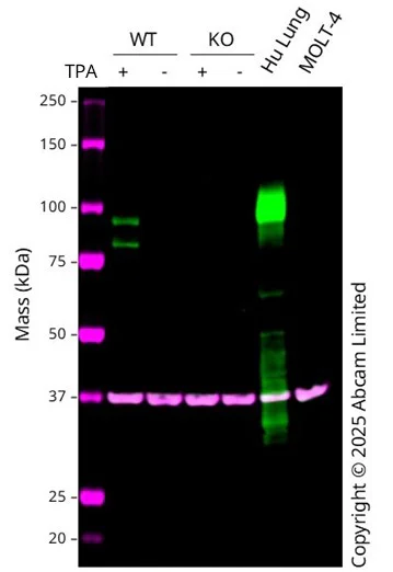 Western blot - Anti-MMP9 antibody [RM1020] (AB283575)