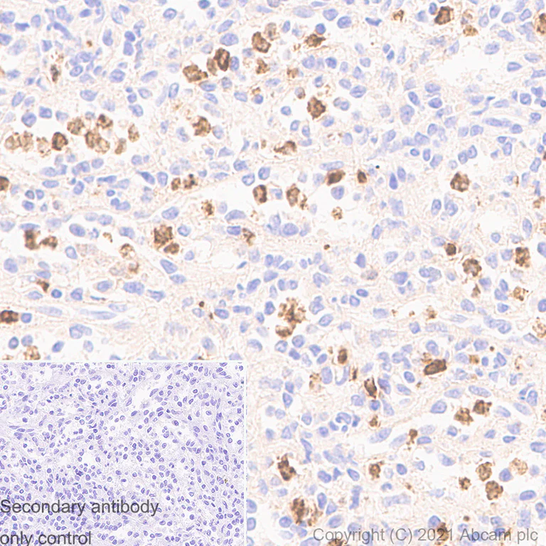 Immunohistochemistry (Formalin/PFA-fixed paraffin-embedded sections) - Anti-MMP9 antibody [RM1020] - BSA and Azide free (AB283594)