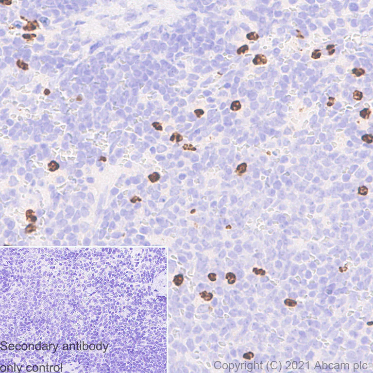 Immunohistochemistry (Formalin/PFA-fixed paraffin-embedded sections) - Anti-MMP9 antibody [RM1020] - BSA and Azide free (AB283594)