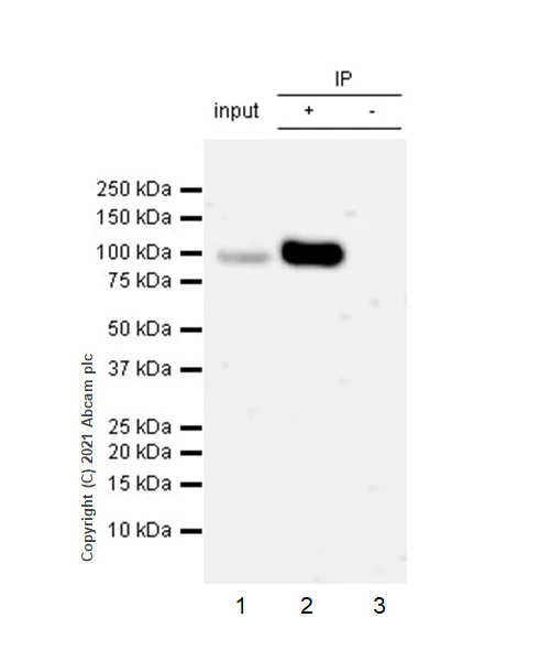 Immunoprecipitation - Anti-MMP9 antibody [RM1020] - BSA and Azide free (AB283594)