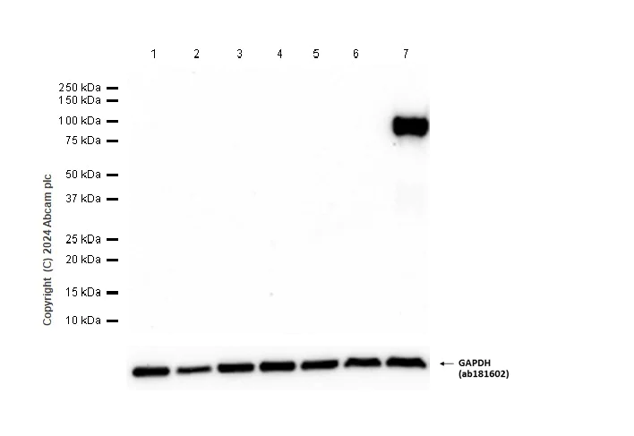 Western blot - Anti-MMP9 antibody [RM1020] - BSA and Azide free (AB283594)