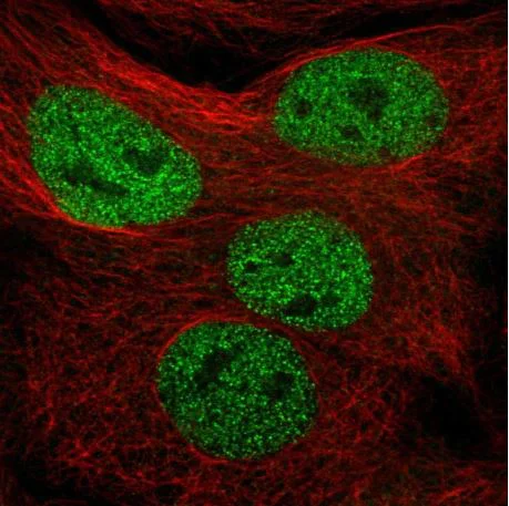 Immunocytochemistry/ Immunofluorescence - Anti-MMS19 antibody (AB188156)