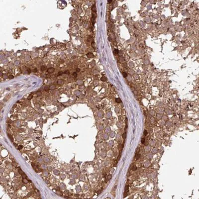 Immunohistochemistry (Formalin/PFA-fixed paraffin-embedded sections) - Anti-MMS19 antibody (AB188156)