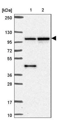 Western blot - Anti-MMS19 antibody (AB188156)