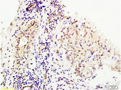 Immunohistochemistry (Formalin/PFA-fixed paraffin-embedded sections) - Anti-MMS19 antibody (AB214328), expandable thumbnail