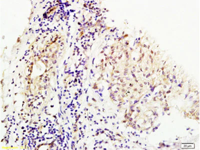 Immunohistochemistry (Formalin/PFA-fixed paraffin-embedded sections) - Anti-MMS19 antibody (AB214328)