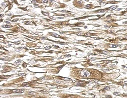 Immunohistochemistry (Formalin/PFA-fixed paraffin-embedded sections) - Anti-MMS2 antibody (AB155007)