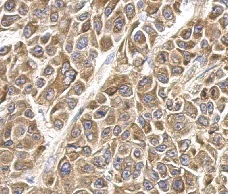 Immunohistochemistry (Formalin/PFA-fixed paraffin-embedded sections) - Anti-MMS2 antibody (AB155007)