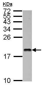 Western blot - Anti-MMS2 antibody (AB155007)