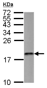 Western blot - Anti-MMS2 antibody (AB155007)