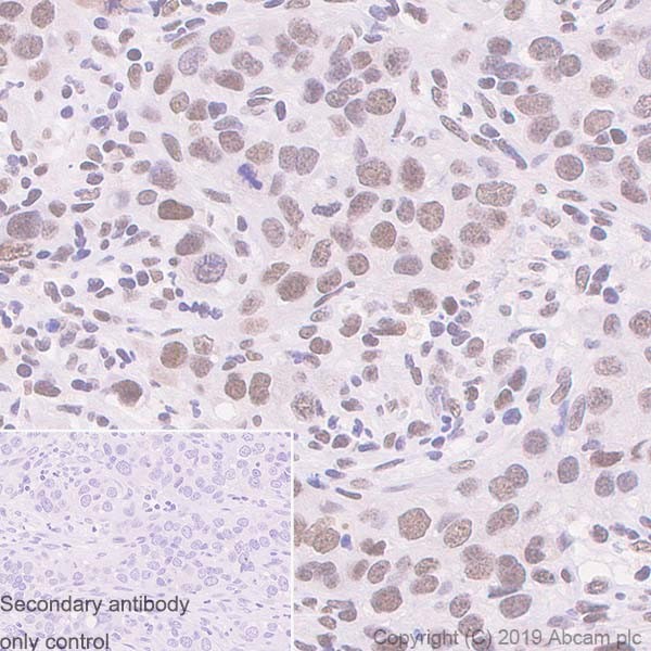 Immunohistochemistry (Formalin/PFA-fixed paraffin-embedded sections) - Anti-MMS21 antibody [215C] (AB241564)