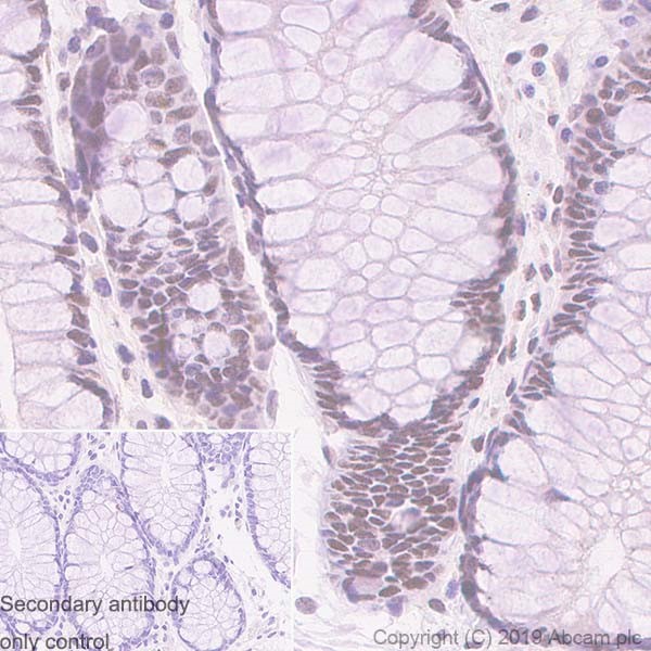 Immunohistochemistry (Formalin/PFA-fixed paraffin-embedded sections) - Anti-MMS21 antibody [215C] (AB241564)
