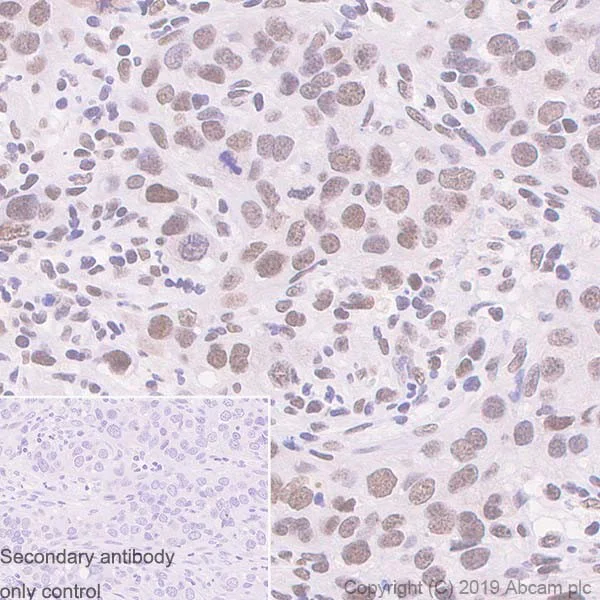 Immunohistochemistry (Formalin/PFA-fixed paraffin-embedded sections) - Anti-MMS21 antibody [215C] - BSA and Azide free (AB255753)