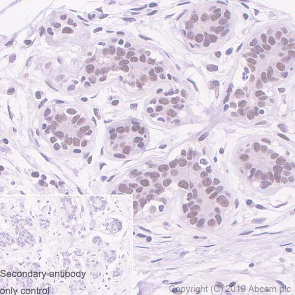 Immunohistochemistry (Formalin/PFA-fixed paraffin-embedded sections) - Anti-MMS21 antibody [215C] - BSA and Azide free (AB255753)
