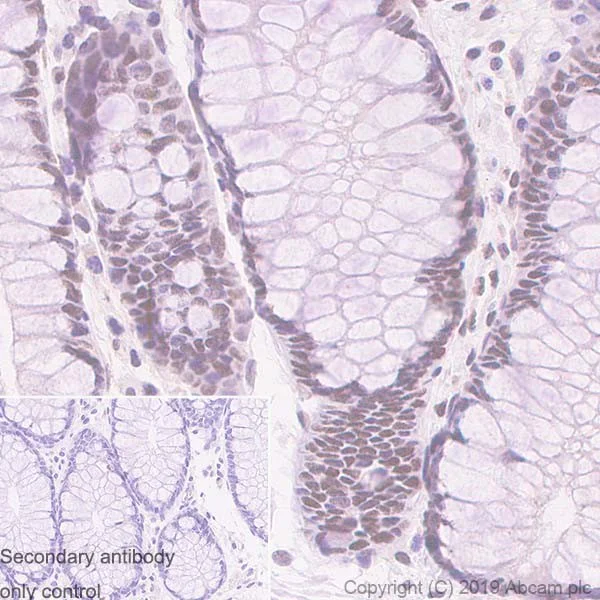 Immunohistochemistry (Formalin/PFA-fixed paraffin-embedded sections) - Anti-MMS21 antibody [215C] - BSA and Azide free (AB255753)
