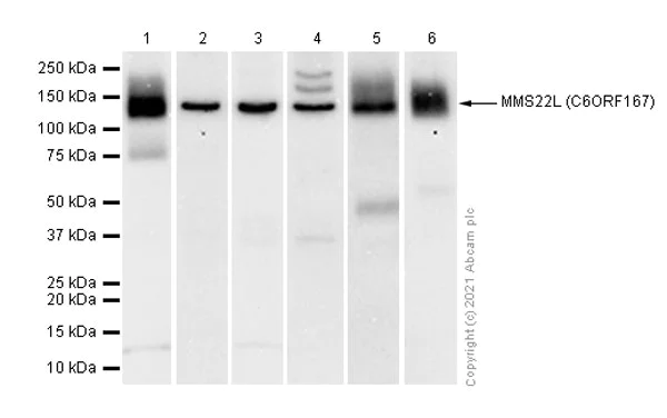 Western blot - Anti-MMS22L (C6ORF167) antibody [EPR13654] - BSA and Azide free (AB250307)