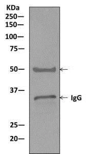 Western blot - Anti-MNAT1 antibody [EPR10940] (AB169546)