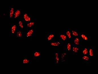 Immunocytochemistry/ Immunofluorescence - Anti-MNAT1 antibody [EPR2555(2)] (AB154802)