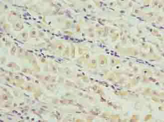 Immunohistochemistry (Formalin/PFA-fixed paraffin-embedded sections) - Anti-MND1 antibody (AB235395)