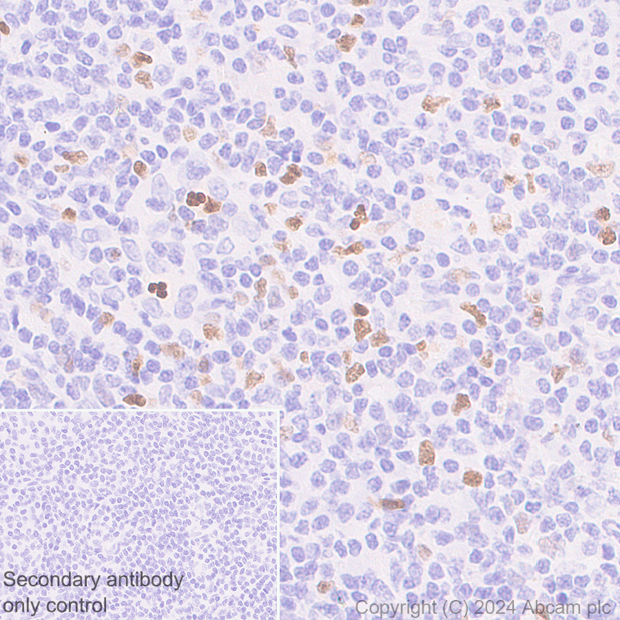 Anti-MNDA antibody [253A]