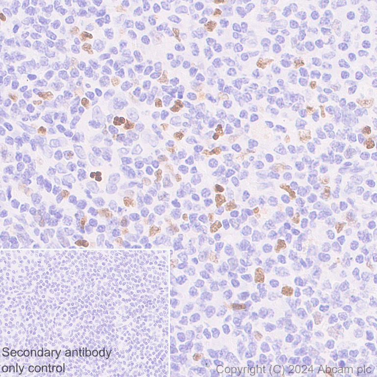 Immunohistochemistry (Formalin/PFA-fixed paraffin-embedded sections) - Anti-MNDA antibody [253A] - BSA and Azide free (AB316211)