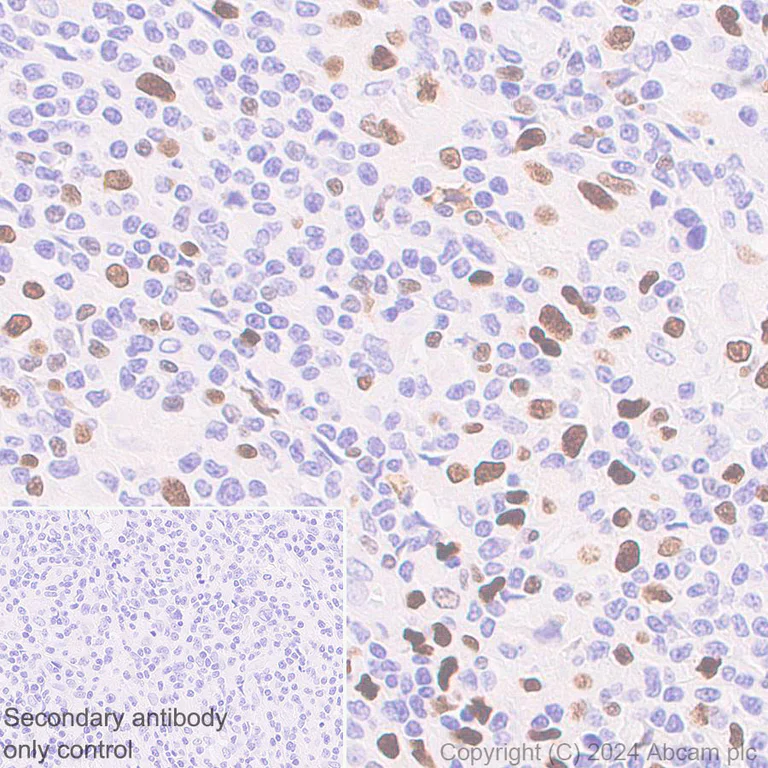 Immunohistochemistry (Formalin/PFA-fixed paraffin-embedded sections) - Anti-MNDA antibody [EPR28267-44] (AB316967)
