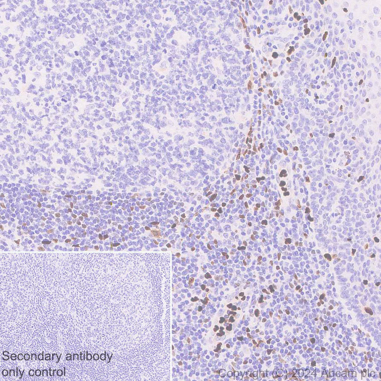 Immunohistochemistry (Formalin/PFA-fixed paraffin-embedded sections) - Anti-MNDA antibody [EPR28267-44] (AB316967)