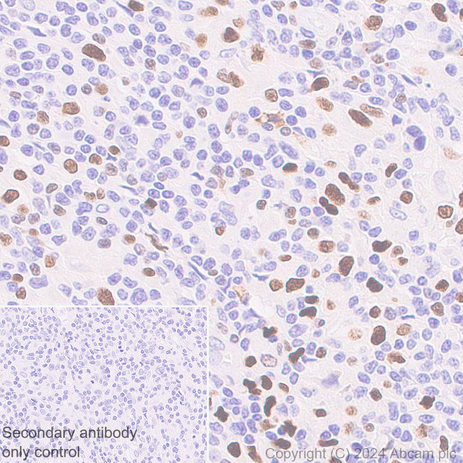 Immunohistochemistry (Formalin/PFA-fixed paraffin-embedded sections) - Anti-MNDA antibody [EPR28267-44] - BSA and Azide free (AB316968)