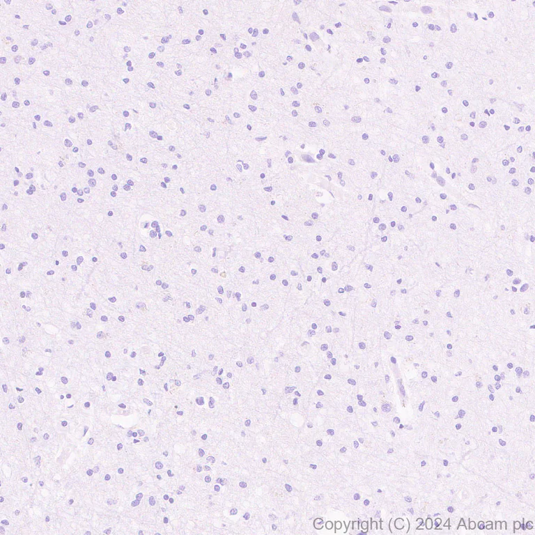 Anti-mNeonGreen antibody [EPR28835-76] (ab321887) | Abcam