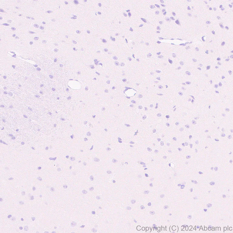 Immunohistochemistry (Formalin/PFA-fixed paraffin-embedded sections) - Anti-mNeonGreen antibody [EPR28835-76] (AB321887)
