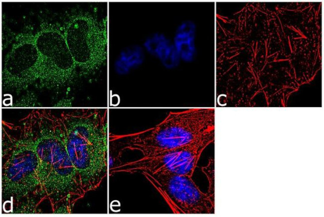 Immunocytochemistry/ Immunofluorescence - Anti-MNK1 antibody [RP23040203] (AB313481)