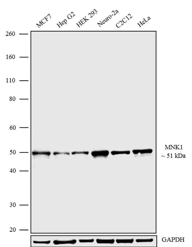 Western blot - Anti-MNK1 Antibody [RP23040203] (AB313481)
