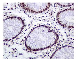 Immunohistochemistry (Formalin/PFA-fixed paraffin-embedded sections) - Anti-MNK1 (phospho T385) antibody [EPR2370] (AB109102)