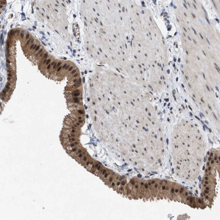 Immunohistochemistry (Formalin/PFA-fixed paraffin-embedded sections) - Anti-MNK2 antibody (AB272591)