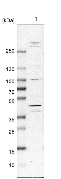 Western blot - Anti-MNK2 antibody (AB272591)