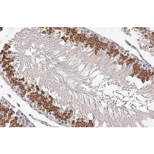 Immunohistochemistry (Formalin/PFA-fixed paraffin-embedded sections) - Anti-MNT antibody [HL2309] (AB317194)