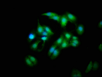 Immunocytochemistry/ Immunofluorescence - Anti-Mob1A antibody (AB236969), expandable thumbnail