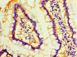 Immunohistochemistry (Formalin/PFA-fixed paraffin-embedded sections) - Anti-Mob1A antibody (AB236969), expandable thumbnail