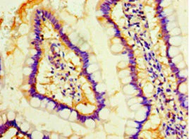 Immunohistochemistry (Formalin/PFA-fixed paraffin-embedded sections) - Anti-Mob1A antibody (AB236969)