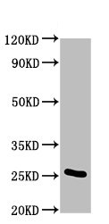 Western blot - Anti-Mob1A antibody (AB236969), expandable thumbnail