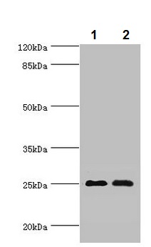 Western blot - Anti-Mob1A antibody (AB236969), expandable thumbnail