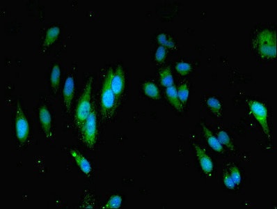 Immunocytochemistry/ Immunofluorescence - Anti-MOCS2 antibody (AB230013)