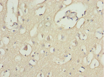 Immunohistochemistry (Formalin/PFA-fixed paraffin-embedded sections) - Anti-MOCS3 antibody (AB229827), expandable thumbnail