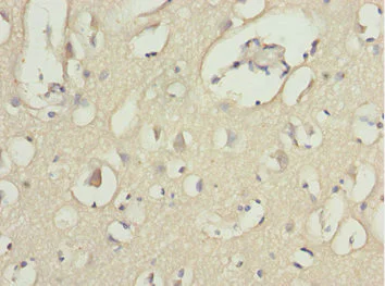 Immunohistochemistry (Formalin/PFA-fixed paraffin-embedded sections) - Anti-MOCS3 antibody (AB229827)