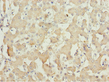 Immunohistochemistry (Formalin/PFA-fixed paraffin-embedded sections) - Anti-MOCS3 antibody (AB229827), expandable thumbnail