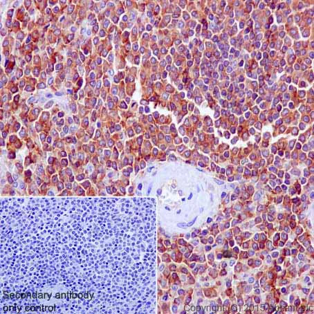 Immunohistochemistry (Formalin/PFA-fixed paraffin-embedded sections) - Anti-Moesin antibody [EP1863Y] - BSA and Azide free (AB232580)