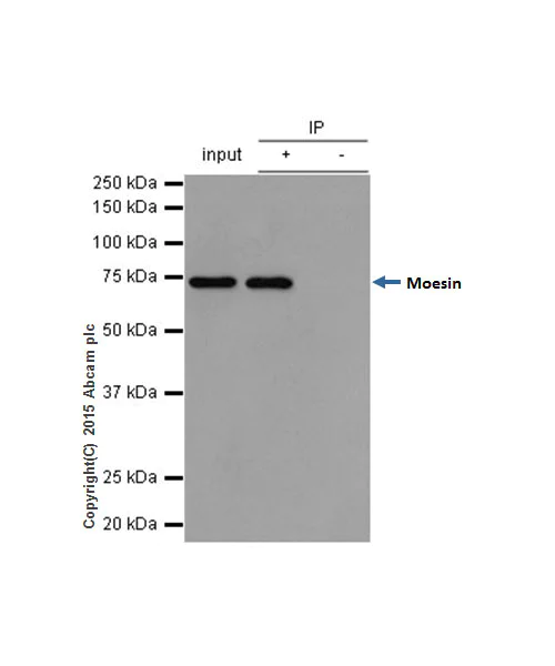 Immunoprecipitation - Anti-Moesin antibody [EP1863Y] - BSA and Azide free (AB232580)